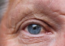 Normal_senior-eye-close-up